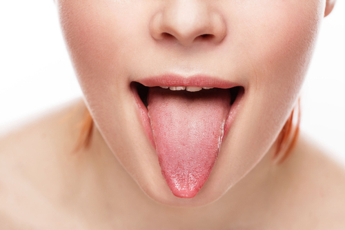 正常な舌の状態
